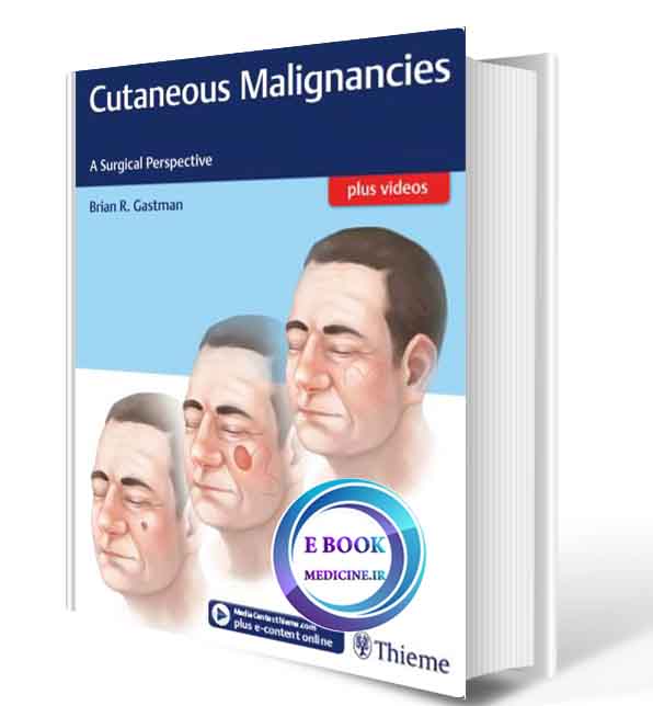 دانلود کتاب  Cutaneous Malignancies: A Surgical Perspective2018(ORIGINAL PDF)